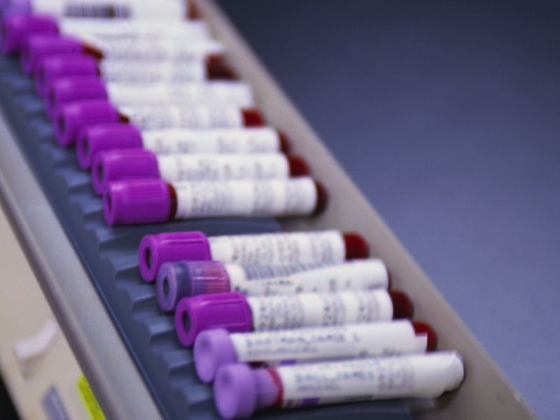 sealed test tubes of blood on a conveyor belt